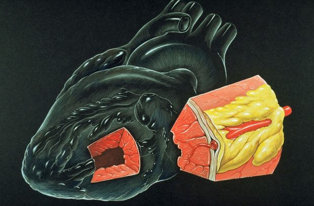 Cardiac muscle / wikipedia.org