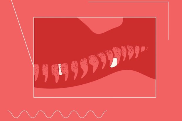 Electrical nerve stimulation improved peripheral nerve function